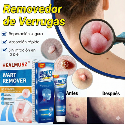 Wart Elimina Verrugas